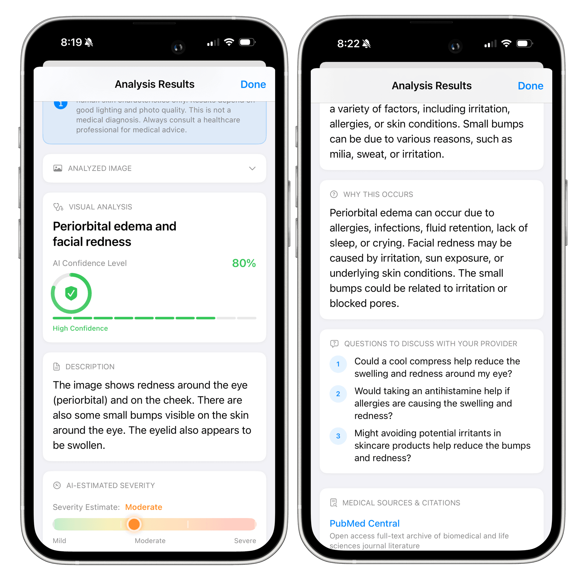 DermaWhiz AI Analysis Results on Mobile Devices